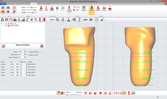 Rodin 4D Néo https://rodin4d.com/fr/produits/rectification/rodin4d-cadcam